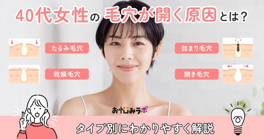 40代女性の毛穴が開く原因とは？タイプ別にわかりやすく解説