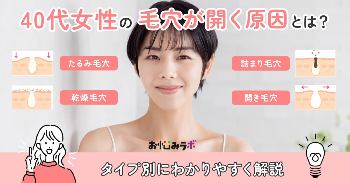 40代女性の毛穴が開く原因とは？タイプ別にわかりやすく解説
