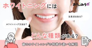 ホワイトニングにはどんな種類がある？特徴や違いを解説