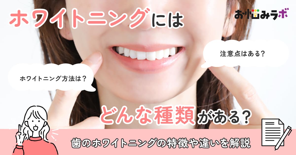 ホワイトニングにはどんな種類がある？特徴や違いを解説