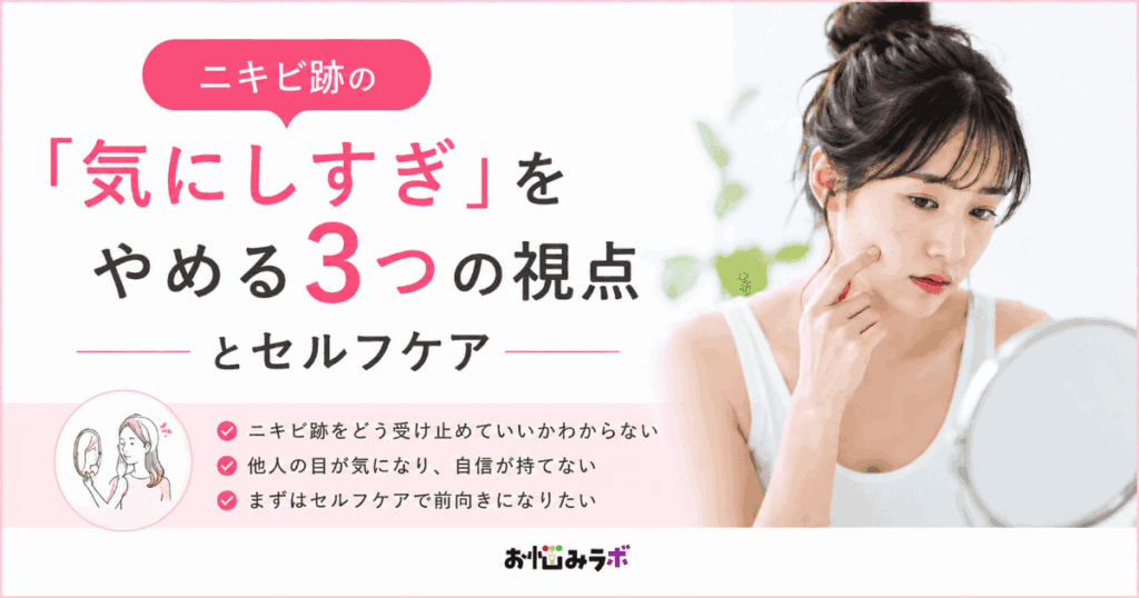 ニキビ跡を気にしすぎて悩む人向けに3つの考え方とセルフケア方法を紹介するアイキャッチ画像