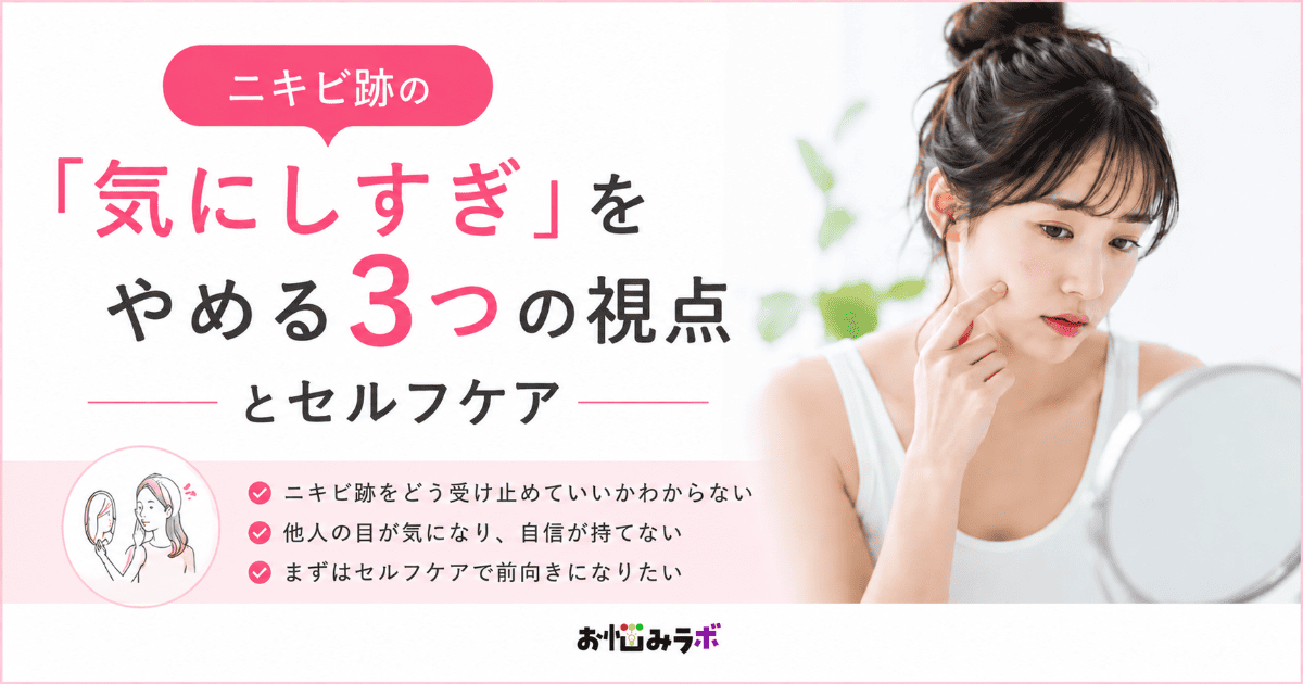 ニキビ跡を気にしすぎて悩む人向けに3つの考え方とセルフケア方法を紹介するアイキャッチ画像