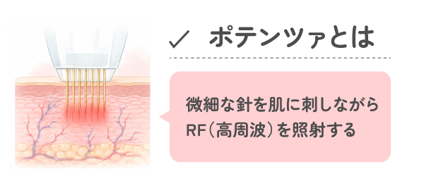 ポテンツァとは