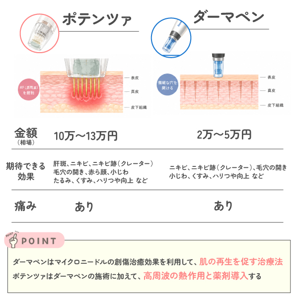 ポテンツァとダーマペンの違い